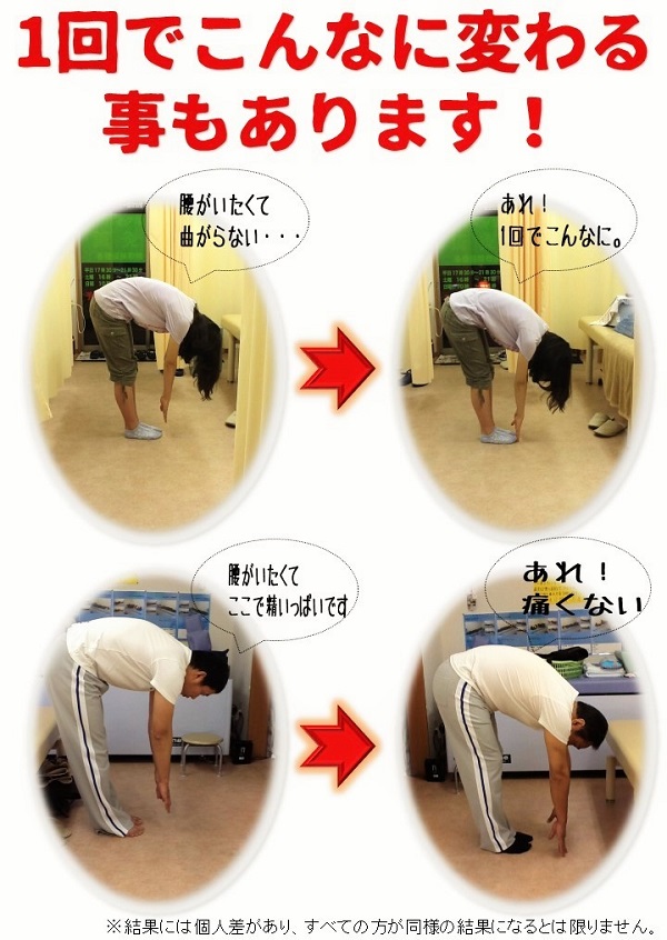 ビフォー アフター 外反母趾 足の痛み専門 整足院武蔵小杉店