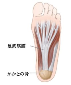 足底筋膜炎 原因と対処方法 外反母趾 足の痛み専門 整足院武蔵小杉店