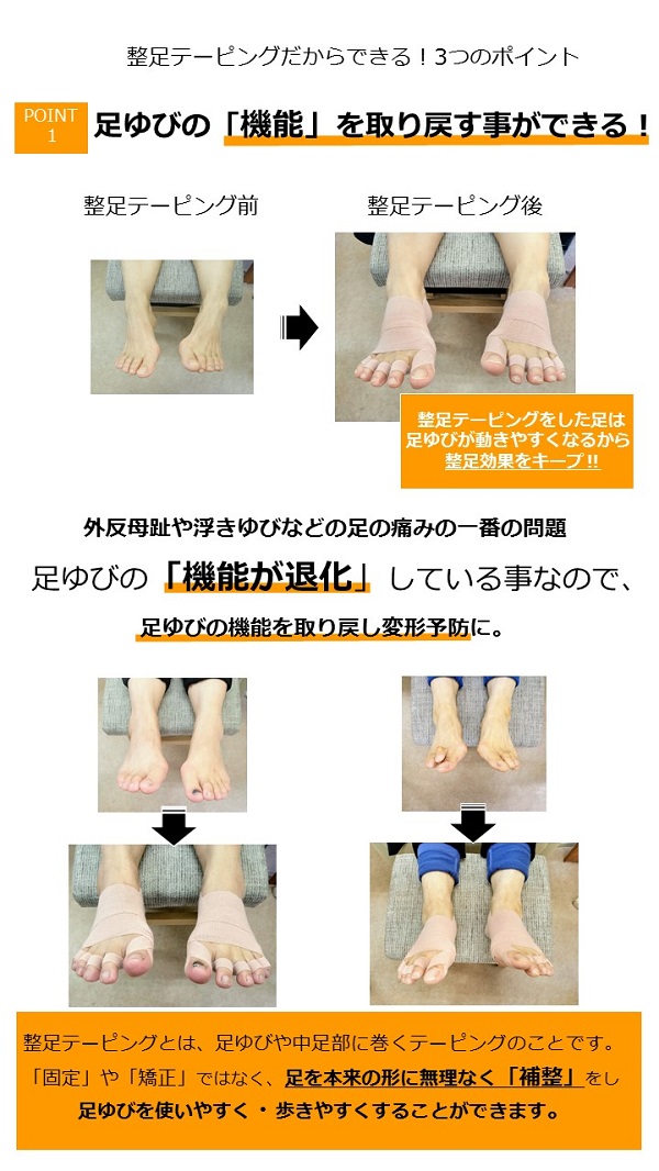 リスフラン関節症の対処方法 外反母趾 足の痛み専門 整足院武蔵小杉店